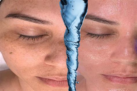 Hydrafacial Solüsyonları Nasıl Kullanılır? Adım Adım Rehber