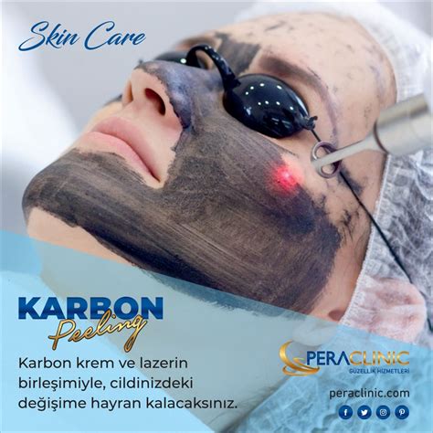 Karbon Peeling: Dermatologlara Sıkça Sorulan Sorular