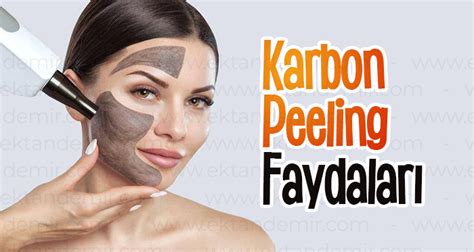 Karbon Peeling Faydaları: Cilt İçin Sağladığı Avantajlar