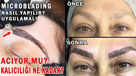 Microblading Sildirme: İşlem Nasıl Yapılır ve Riskleri Nelerdir?