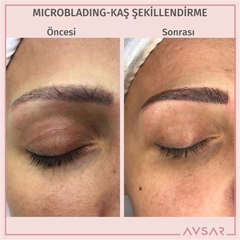 Microblading ile Diğer Kaş Şekillendirme Yöntemleri Karşılaştırması