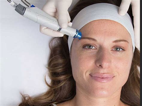 Hydrafacial Ne İşe Yarar